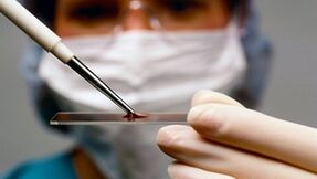 Diagnose van arthroten en artrose